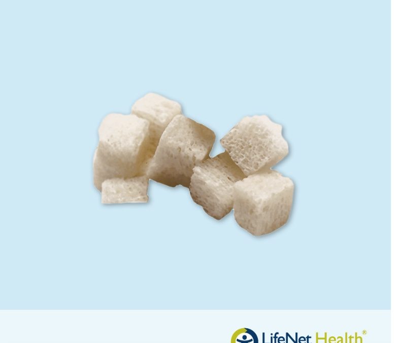 Bloque de Hueso Esponjoso