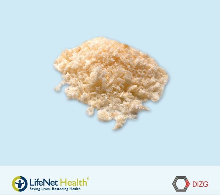 Hueso Cortico-Esponjoso Particulado 50:50 (FDBA)