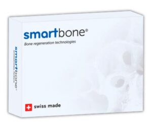 smartbone